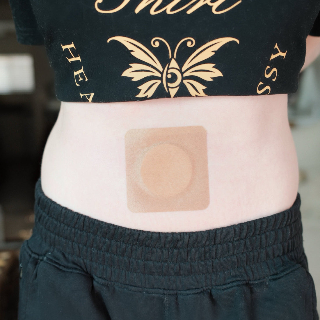 A disposable navel patch placed over the belly button for overnight castor oil navel oiling